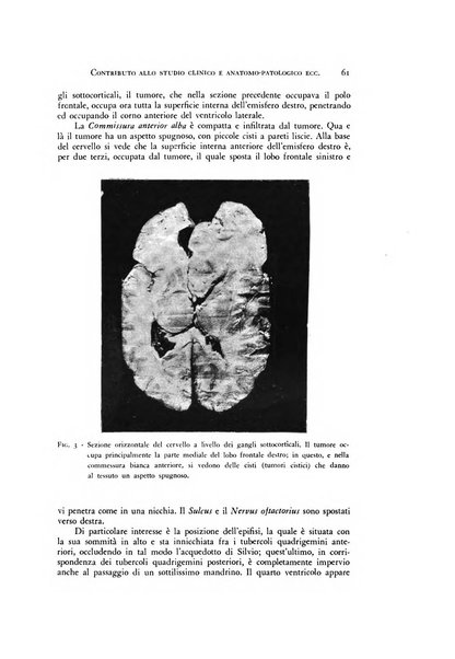 Rivista di neurologia