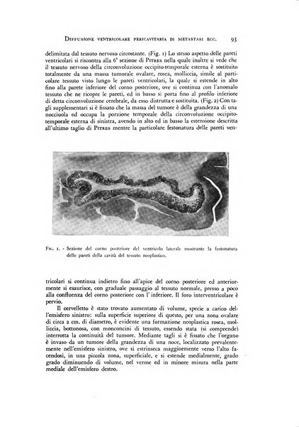 Rivista di neurologia