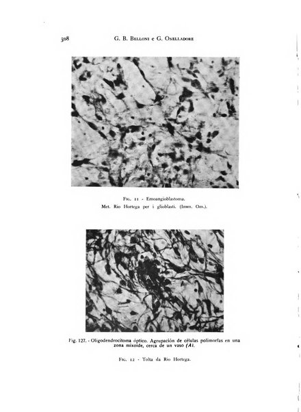 Rivista di neurologia