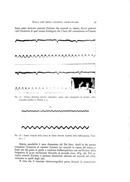 Rivista di neurologia