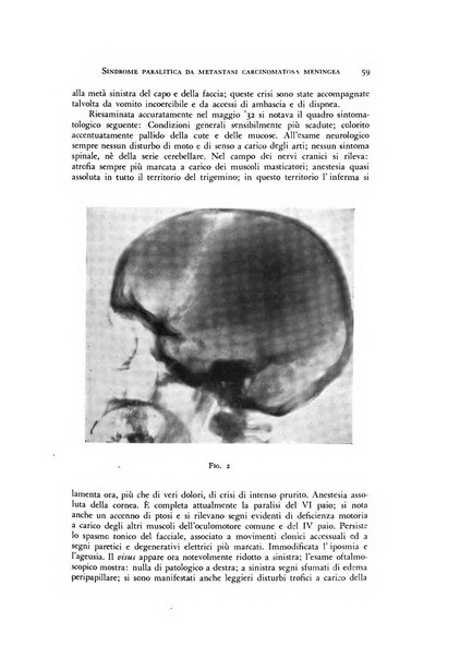 Rivista di neurologia