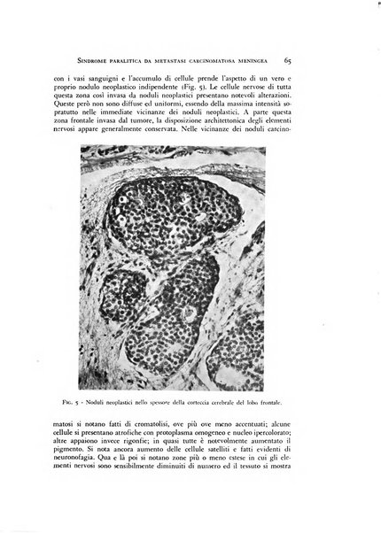 Rivista di neurologia