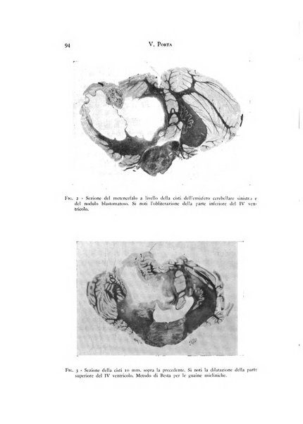 Rivista di neurologia