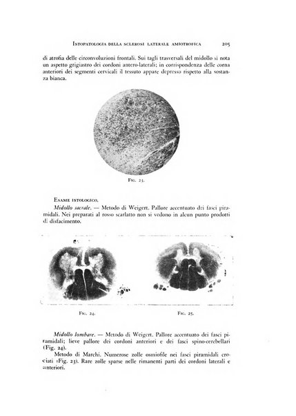 Rivista di neurologia