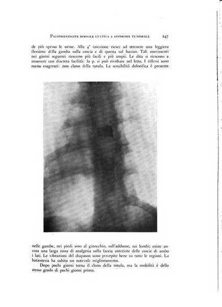 Rivista di neurologia