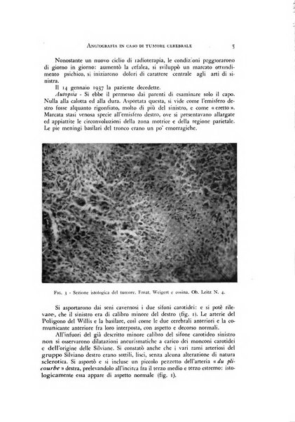 Rivista di neurologia