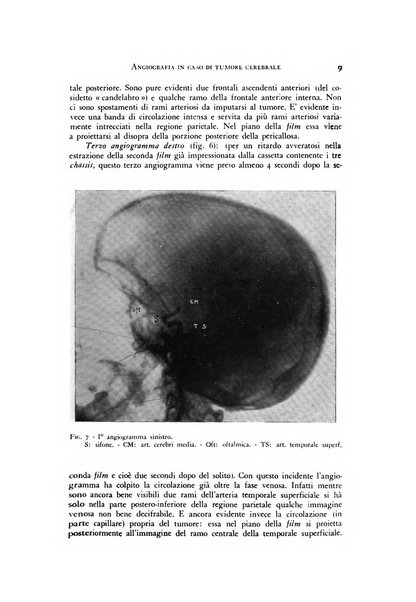 Rivista di neurologia