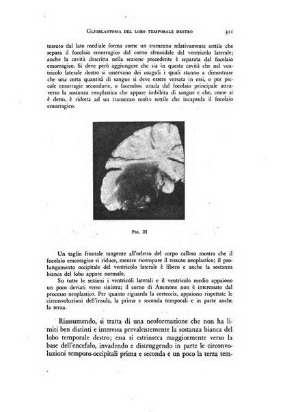 Rivista di neurologia