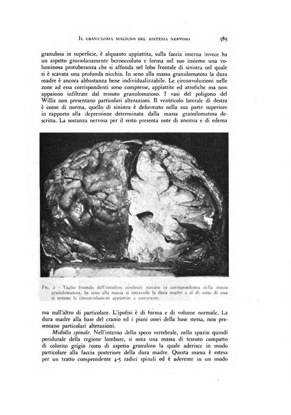 Rivista di neurologia