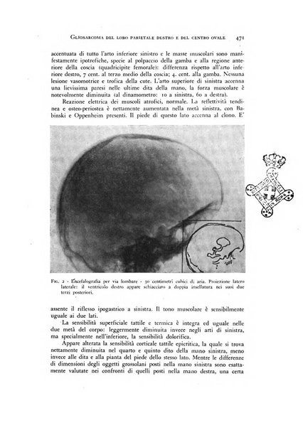 Rivista di neurologia