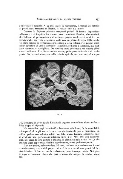 Rivista di neurologia