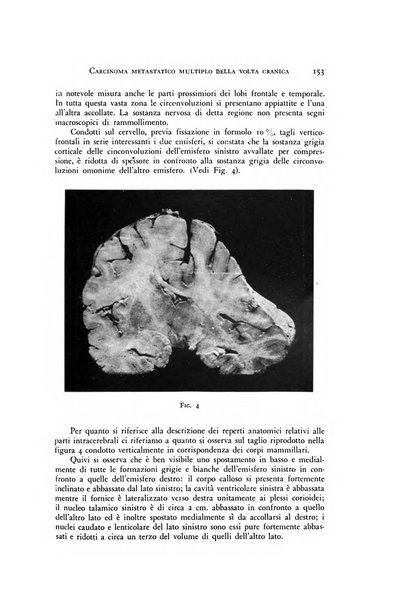 Rivista di neurologia