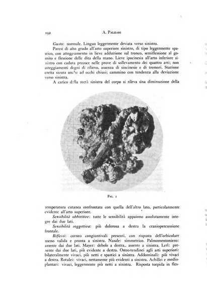 Rivista di neurologia