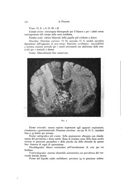 Rivista di neurologia