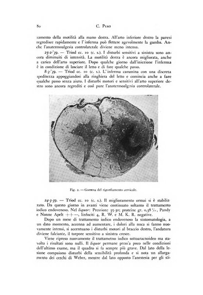 Rivista di neurologia