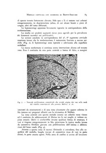 Rivista di neurologia