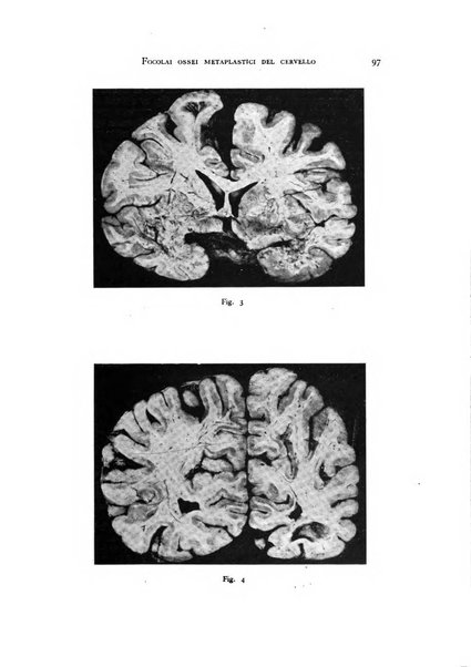 Rivista di neurologia