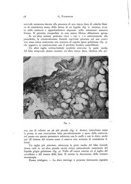 Rivista di neurologia