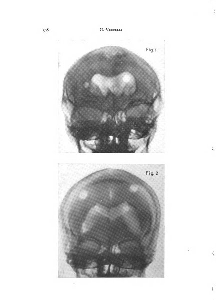 Rivista di neurologia