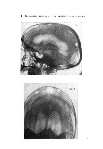 Rivista di neurologia