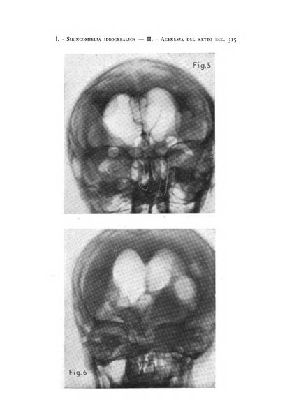 Rivista di neurologia