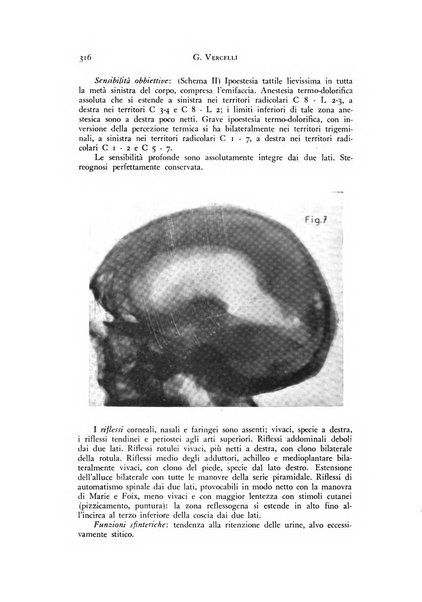 Rivista di neurologia