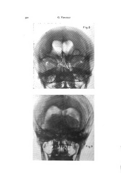 Rivista di neurologia