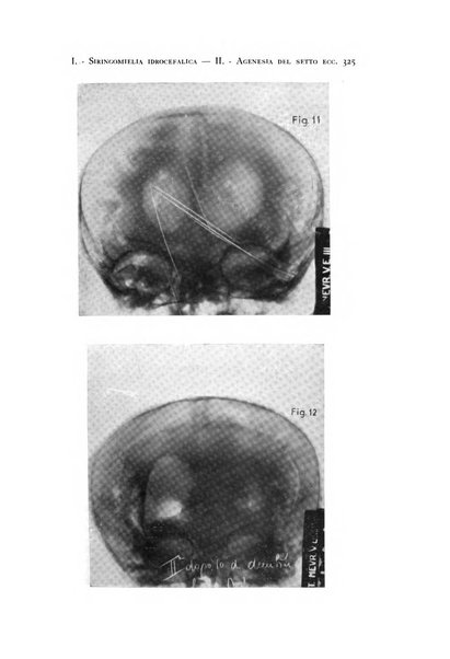 Rivista di neurologia