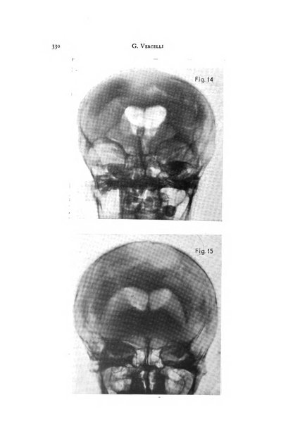 Rivista di neurologia