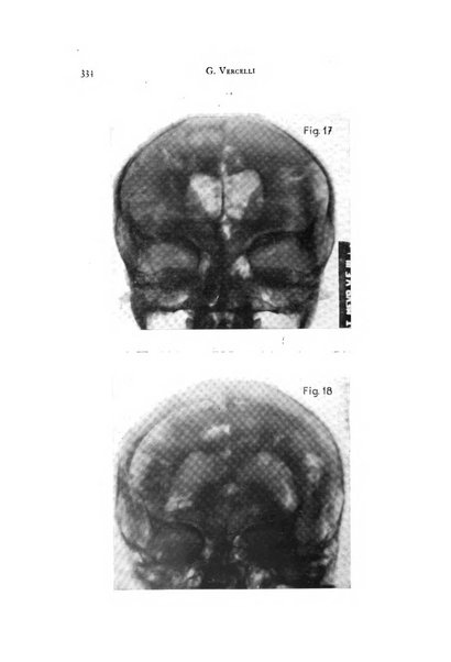 Rivista di neurologia