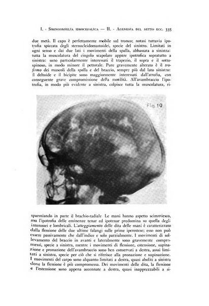 Rivista di neurologia