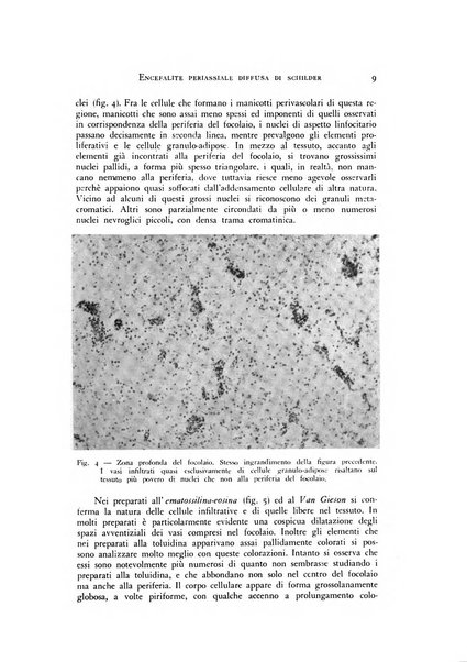 Rivista di neurologia