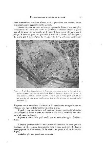 Rivista di neurologia