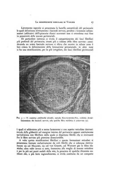 Rivista di neurologia