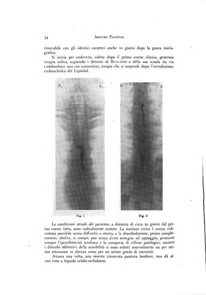 Rivista di neurologia