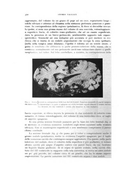 Rivista di neurologia