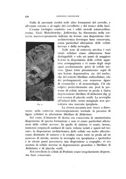 Rivista di neurologia