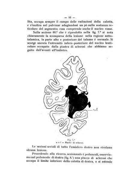 Annali di nevrologia