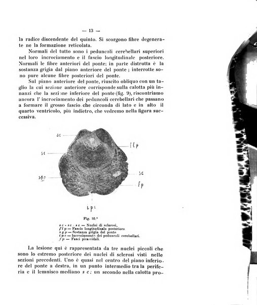 Annali di nevrologia