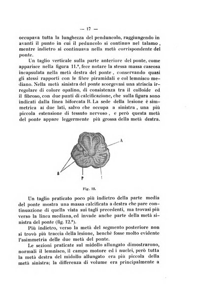 Annali di nevrologia