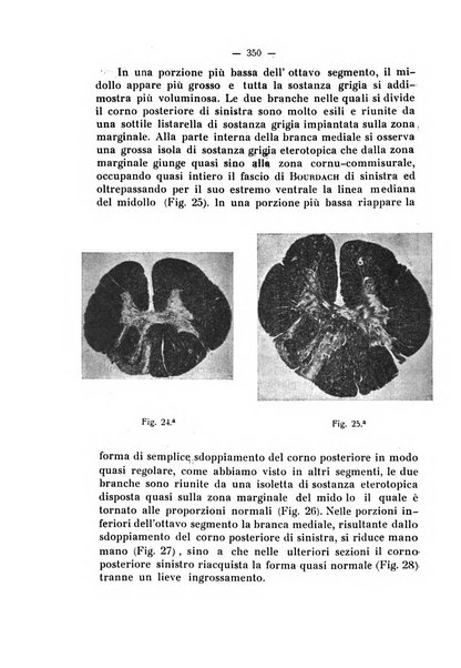 Annali di nevrologia