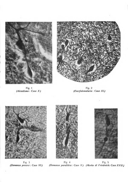 Annali di nevrologia