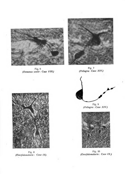 Annali di nevrologia