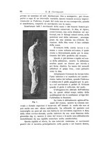 giornale/NAP0160688/1913/unico/00000112