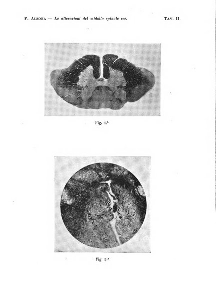 Annali di nevrologia