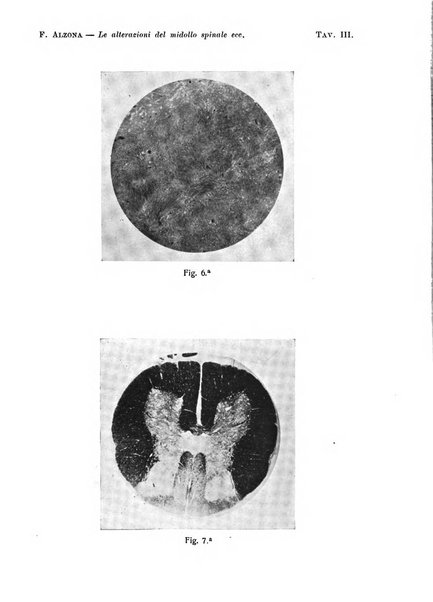 Annali di nevrologia