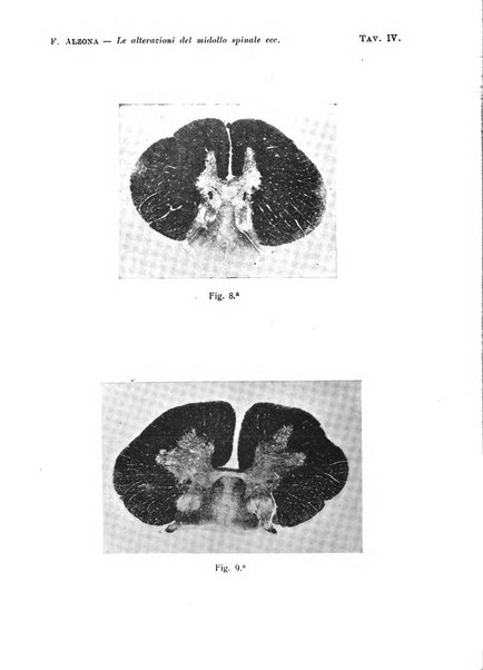 Annali di nevrologia