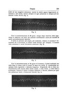 giornale/NAP0160688/1914/unico/00000263