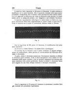 giornale/NAP0160688/1914/unico/00000264