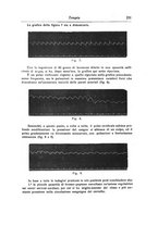 giornale/NAP0160688/1914/unico/00000265